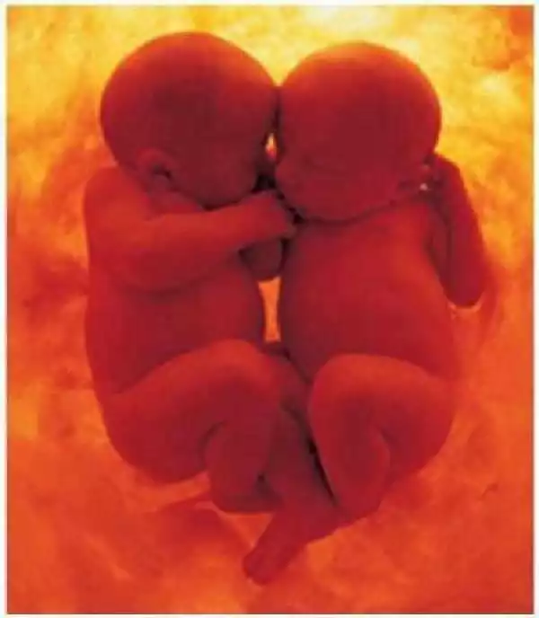 Did You Know Twins from Different Fathers Could Be in One Womb at the Same Time? Read the Scientific Explanation